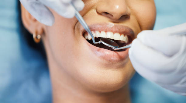 Best Emergency Treatment for Oral Infections in Lan, MI